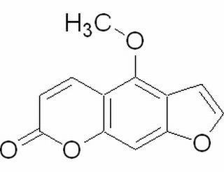 ָ